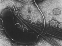 Vibrio cholerae