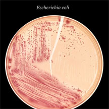 e coli in a petri dish